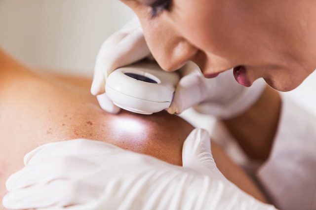 Dermato consulta dermatologista