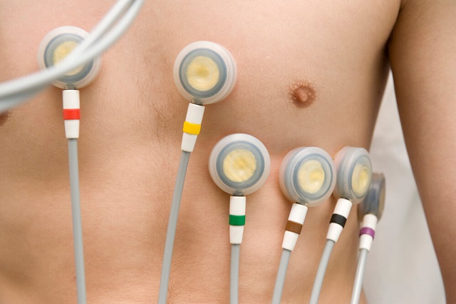 eletrocardiograma