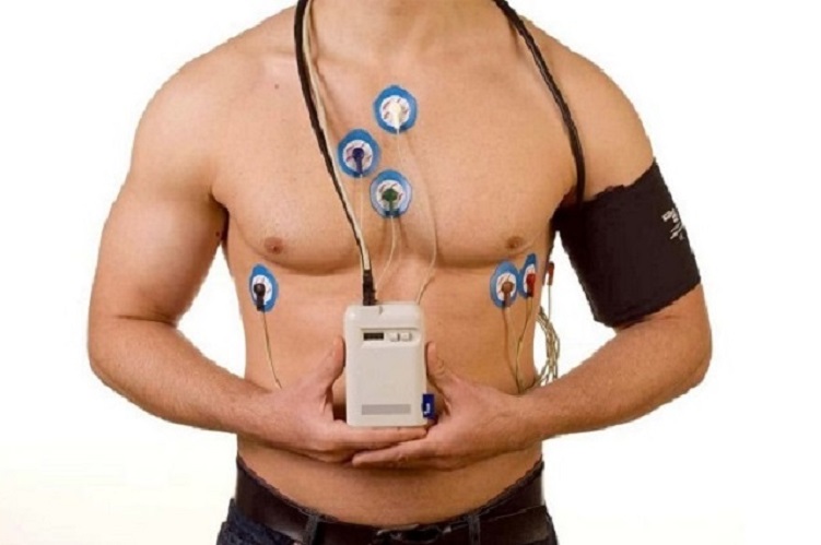 Holter 24h Belford Roxo